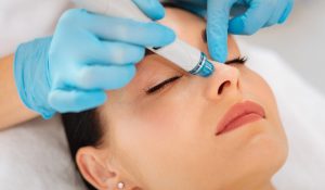 hydrafacial-1000x584-1